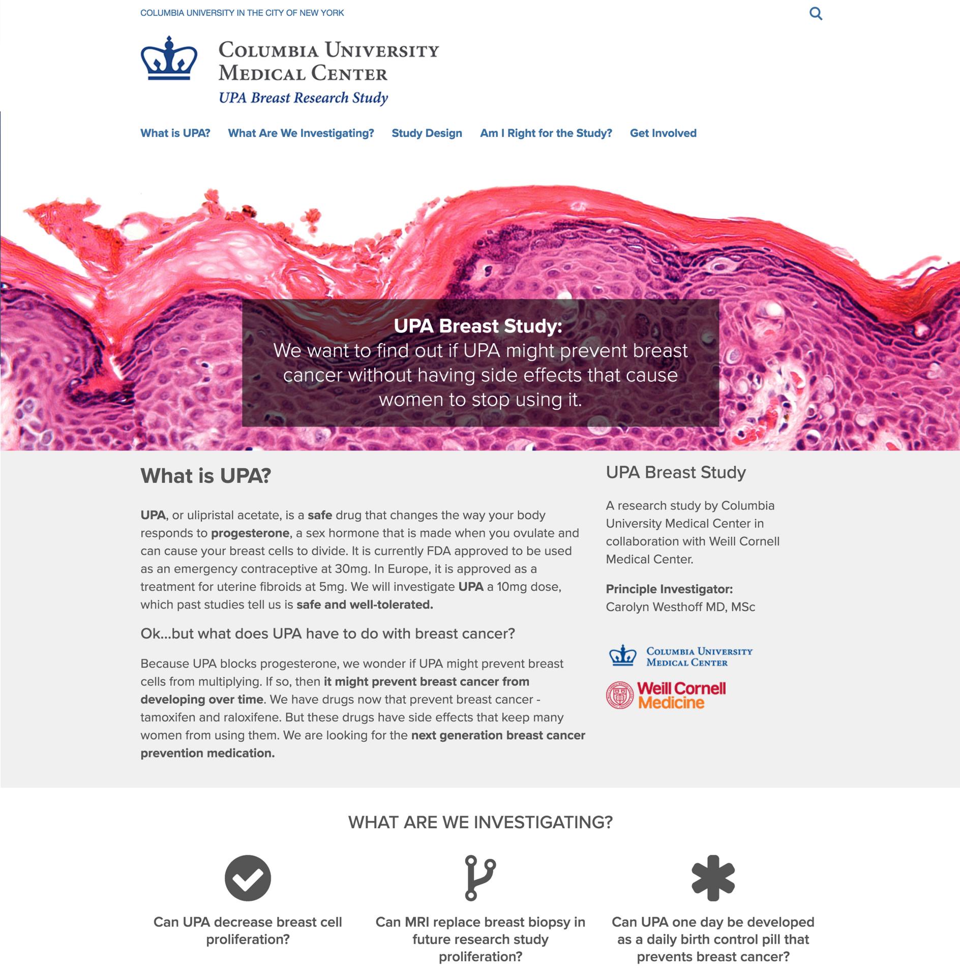 UPA Breast Study Screen grab of the UPA Breast Study site